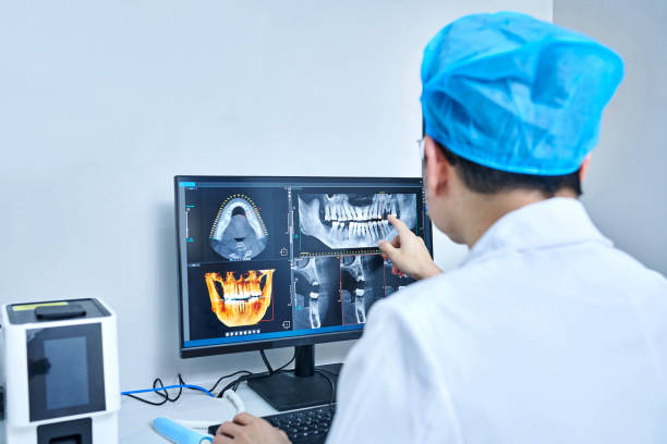Best Dental Abscess Treatment in Mount Sterling, OH